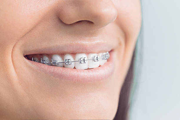 Best Dental Inlays and Onlays  in Shoreacres, TX